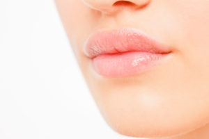Lip Augmentation Artefill - Sassan Alavi MD Cosmetic Surgery Center San Diego