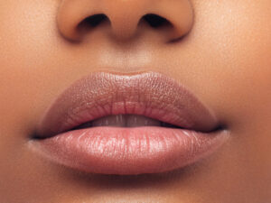 Lip lift surgery - get beautiful lips with the Center for Cosmetic Surgery