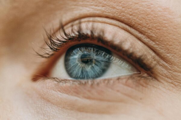 Eyelid Surgery - Is it right for you?